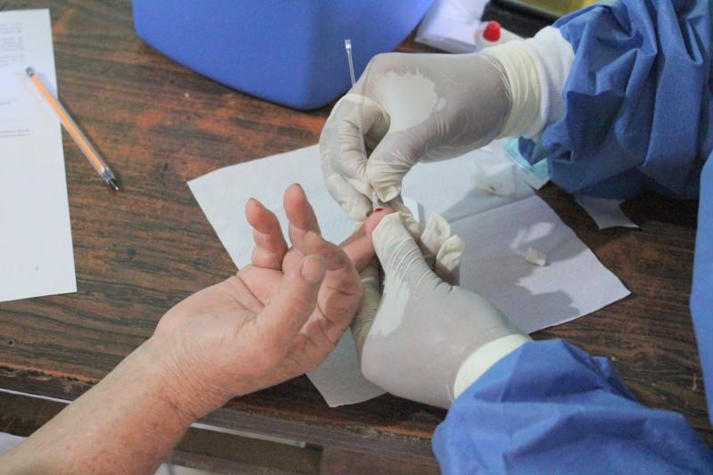 Falso positivo ou falso negativo? Pacientes relatam resultados diferentes em testes da Covid-19